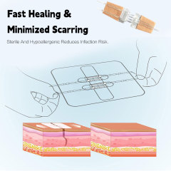 Wundverschlussgerät/Hautklammergeräte