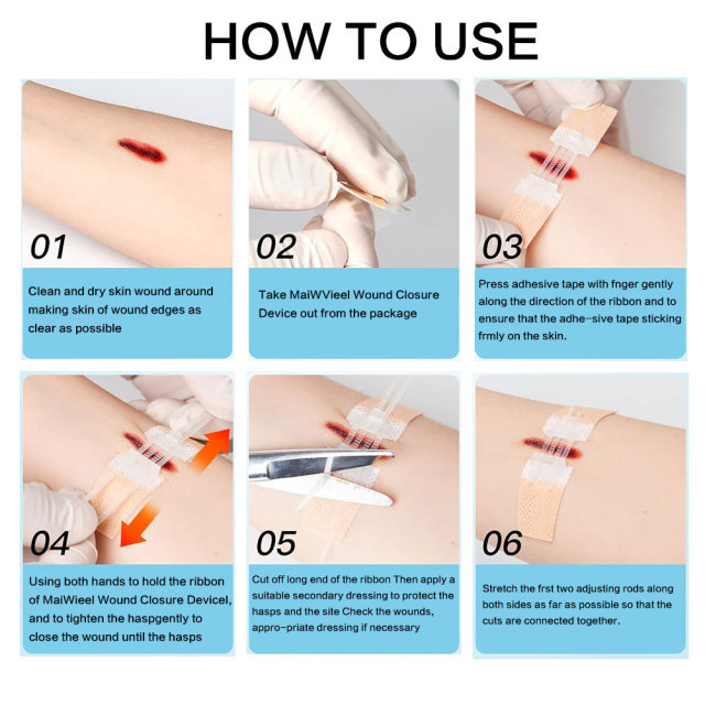 Wundverschlussgerät/Hautklammergeräte