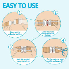 Wundverschlussgerät/Hautklammergeräte