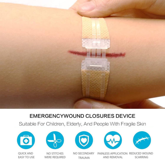 Wundverschlussgerät/Hautklammergeräte