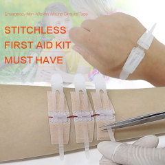 Wundverschlussgerät/Hautklammergeräte