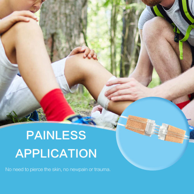 Wundverschlussgerät/Hautklammergeräte