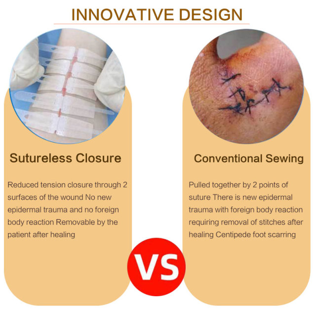 Wundverschlussgerät/Hautklammergeräte