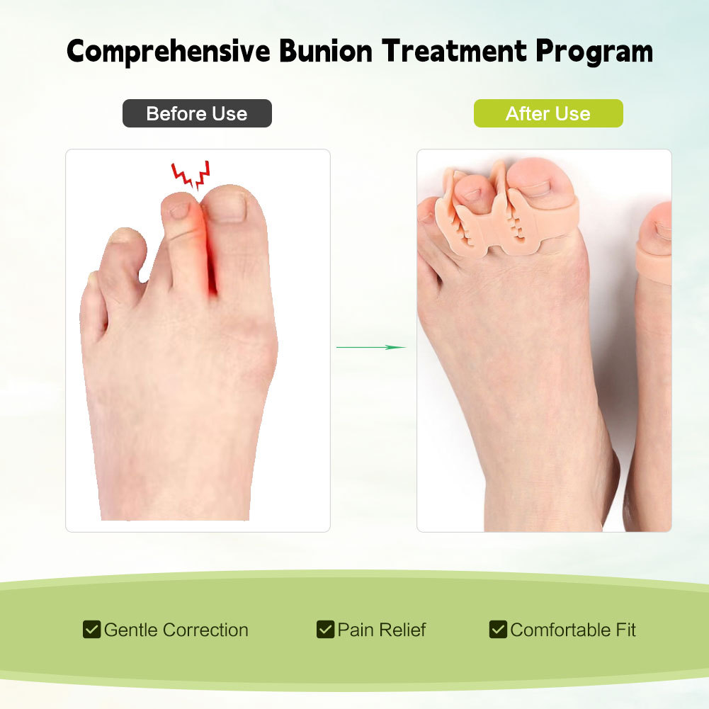 Four toe orthosis