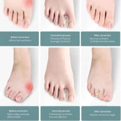 Ballenzehen-Korrektor