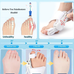 Adjustable Bunion Corrector