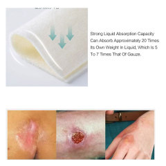 Extra Silber-Alginat-Verband