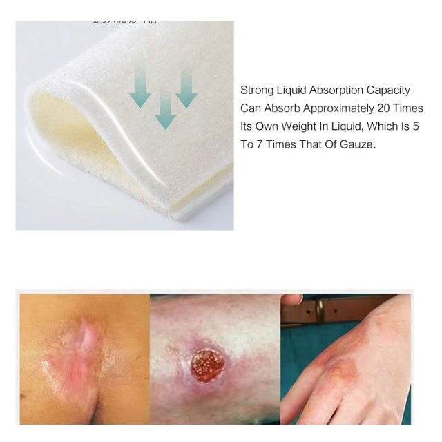 Extra Silber-Alginat-Verband