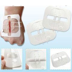 Wundverschlussgerät/Hautklammergeräte