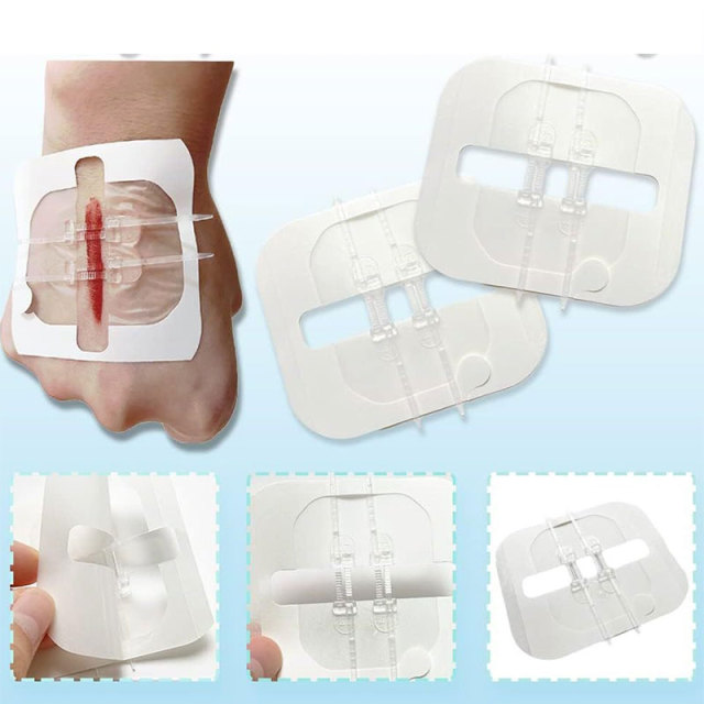 Wundverschlussgerät/Hautklammergeräte