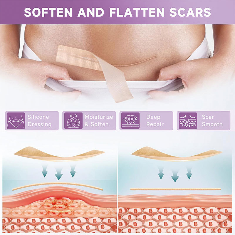 Ruban de silicone