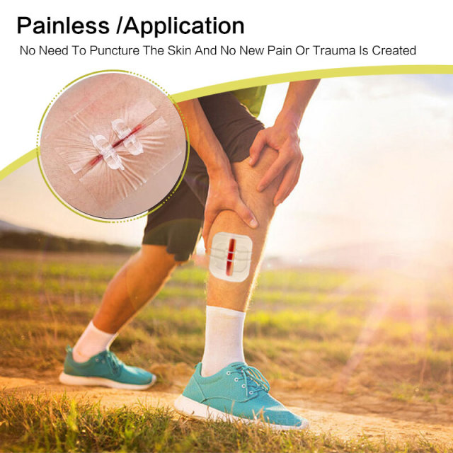 Wundverschlussgerät/Hautklammergeräte