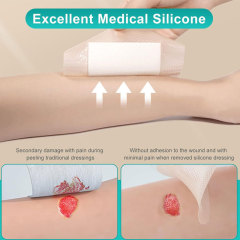 Silikon-Ag-Schaumverband