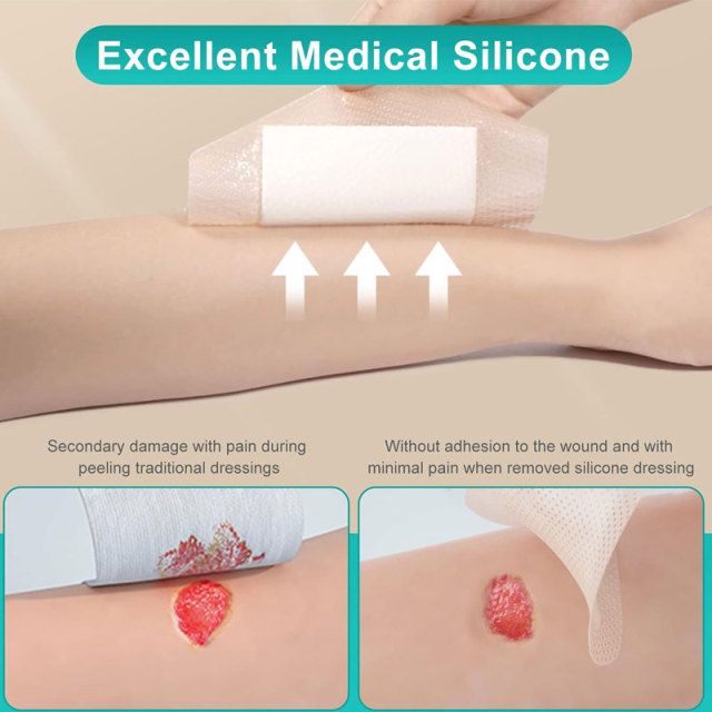 Silikon-Ag-Schaumverband