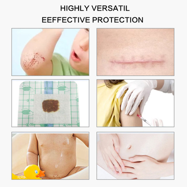 Silicone Postoperative Dressing Adhesive