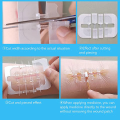 Wundverschlussgerät/Hautklammergeräte