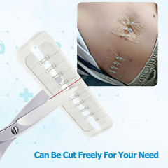 Wound Closure Device/Skin Staplers