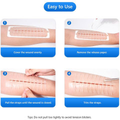 Wundverschlussgerät/Hautklammergeräte