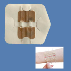 Wundverschlussgerät/Hautklammergeräte