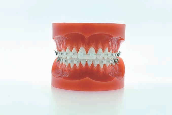 Low Friction System T21