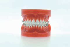 Low Friction System T21