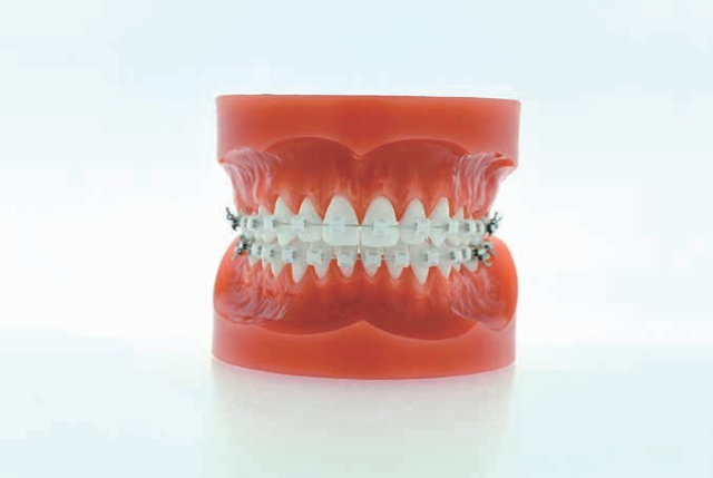 Low Friction System T21