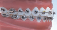 Standard Edgewise Maxillary Arch