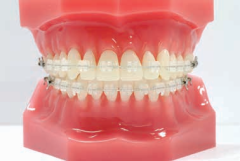 "Crystaline® 8 (OPA-K®)" Ceramic Brackets