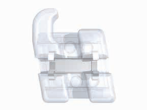 Formula-R (Roth Type) Maxillary Arch