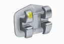 Formula-R (Roth Type) Maxillary Arch