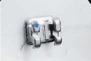 Succes® Maxillary Arch