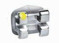 Formula-R (Roth Type) Maxillary Arch