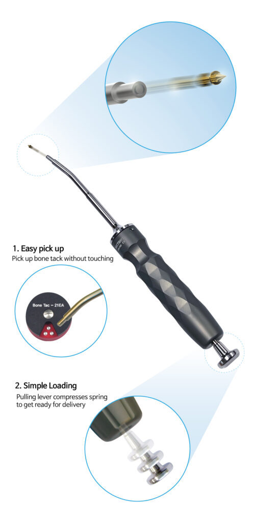 AUTO BONE TAC SYSTEM