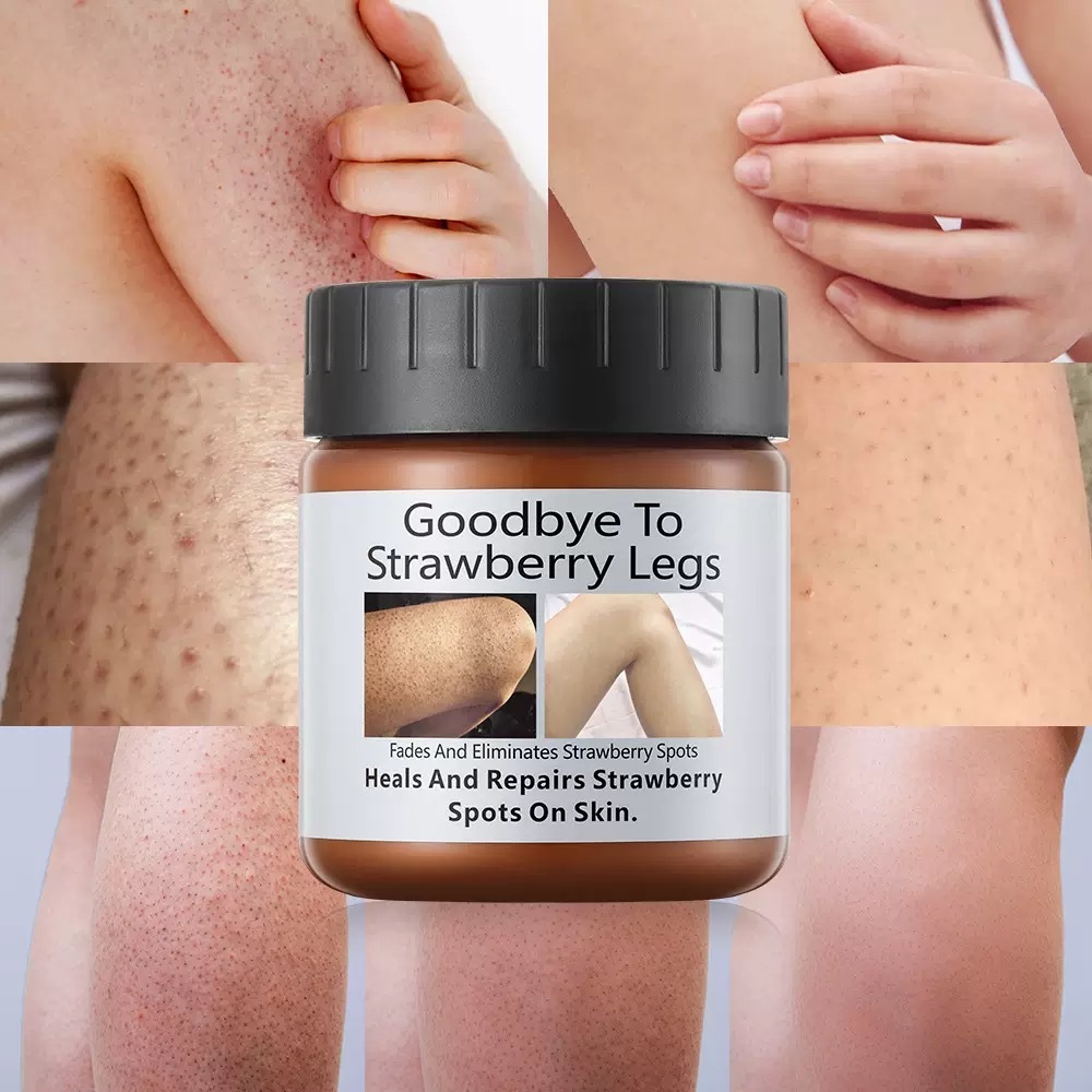 Crema para desvanecer manchas de la piel / piernas y brazos