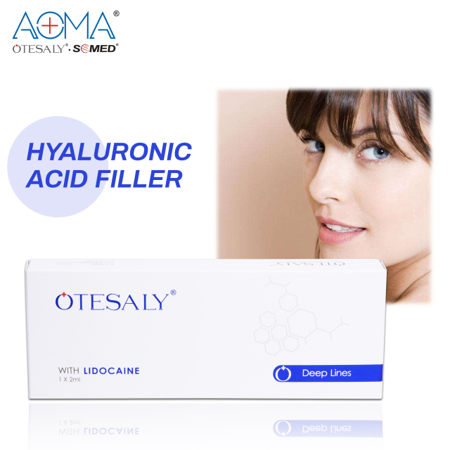 OTESALY® 2ml Deep Lines with Lidocaine OEM Hyaluronic Acid Fillers wholesale