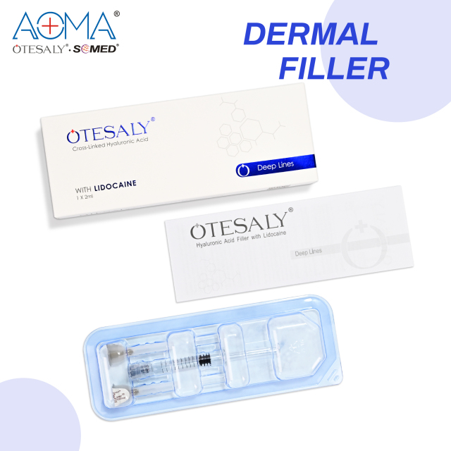 OTESALY® 2ml Deep Lines with Lidocaine OEM Hyaluronic Acid Fillers wholesale