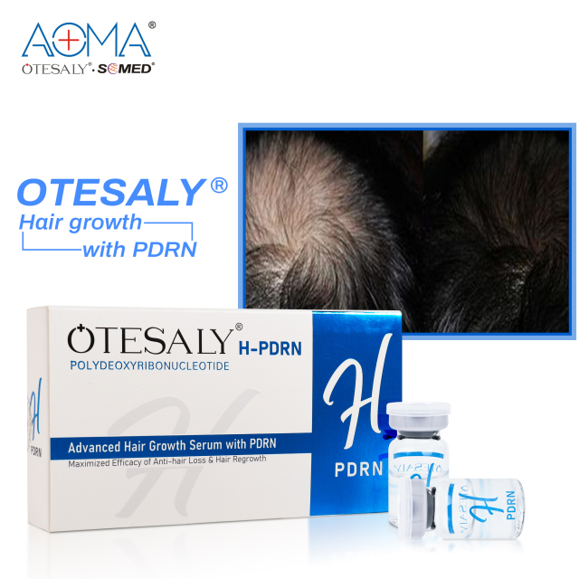 OTESALY® Advanced Hair Growth Serum with PDRN for Hair Regrowth