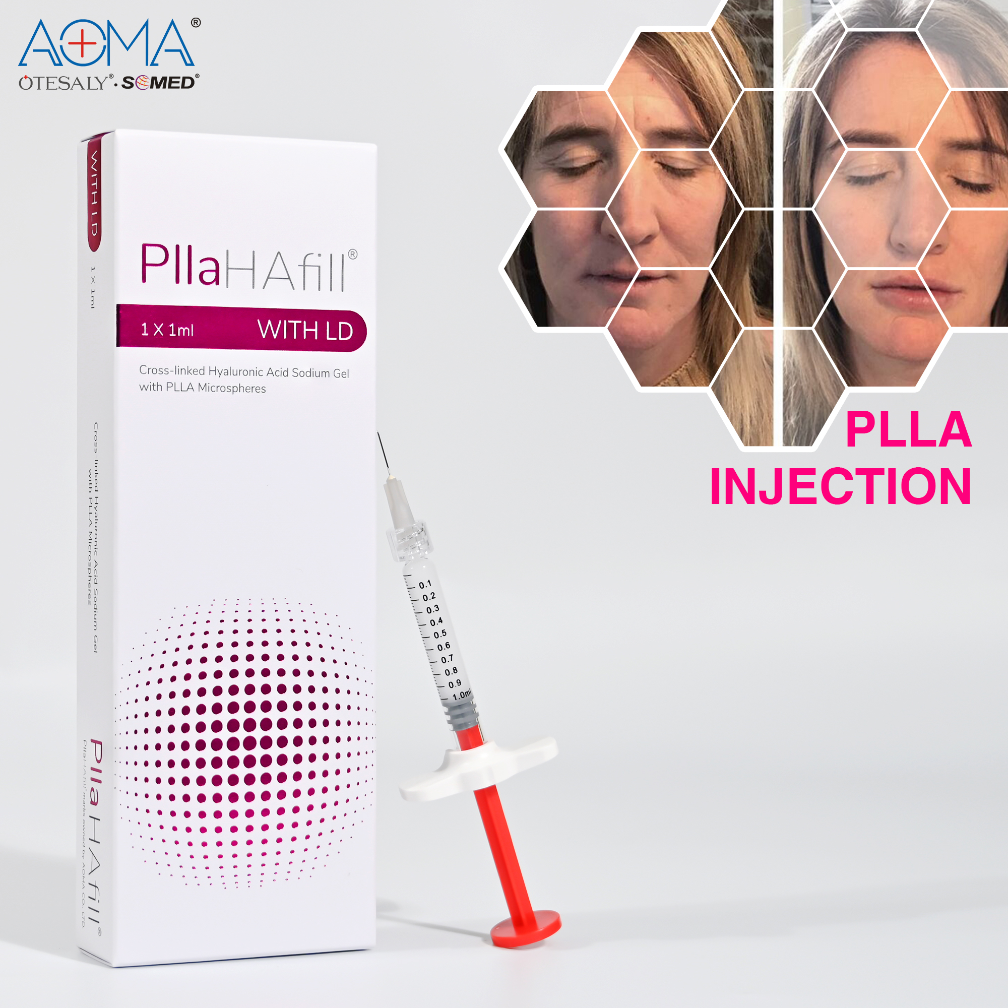 CE Approved Injectable Poly-l-lactic Acid Hyaluronic Acid Filler for Anti Wrinkles