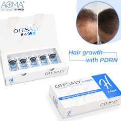 OTESALY® Advanced Hair Growth Serum with PDRN for Hair Regrowth