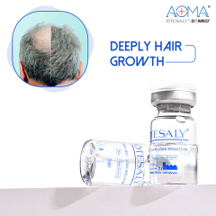 OTESALY® Anti-hair Loss Solution OEM Mesotherapy Solution Hair Rrgrowth Injection Meso Treatment