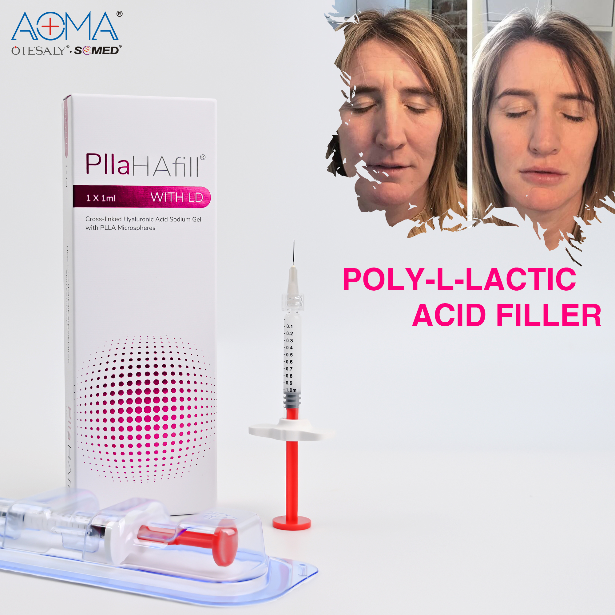 CE Approved Injectable Poly-l-lactic Acid Hyaluronic Acid Filler for Anti Wrinkles