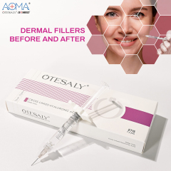 MEDICAL GRADE OTESALY DEEP LINES 2ML WRINKLE REDUCTION SMOOTH DYNAMIC WRINKLE