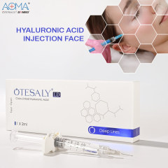 CE Approved OTESALY DEEP LINES 2ML LIDO Hyaluronic Acid Filler Nasolabial Folds