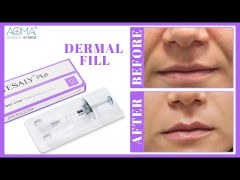 COSMETIC CLINIC OTESALY PLUS  2ML DEEP LINES HYDRATION FILLER NOSE BRIGDE