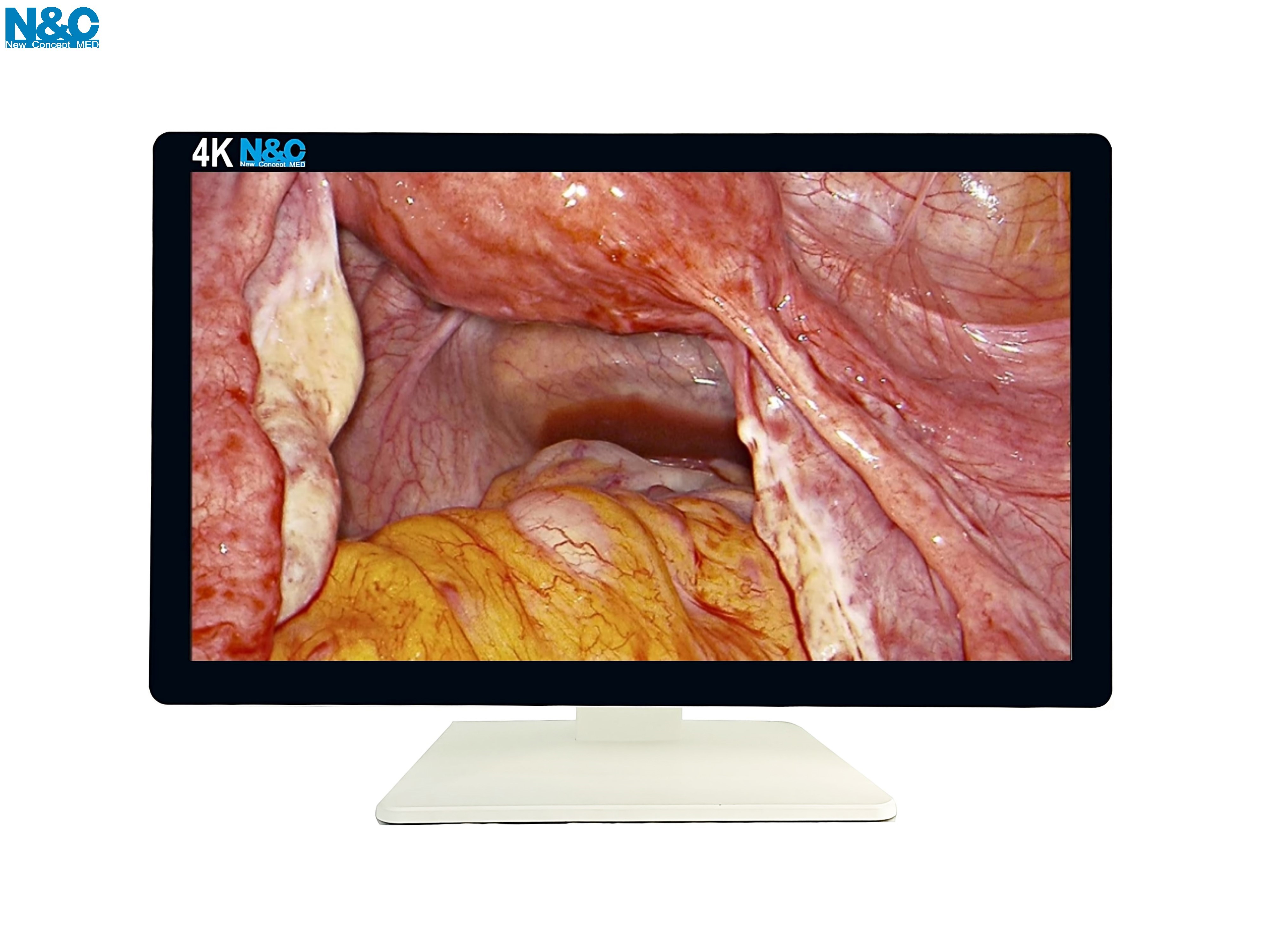 32 inches medical monitor - Medical monitor