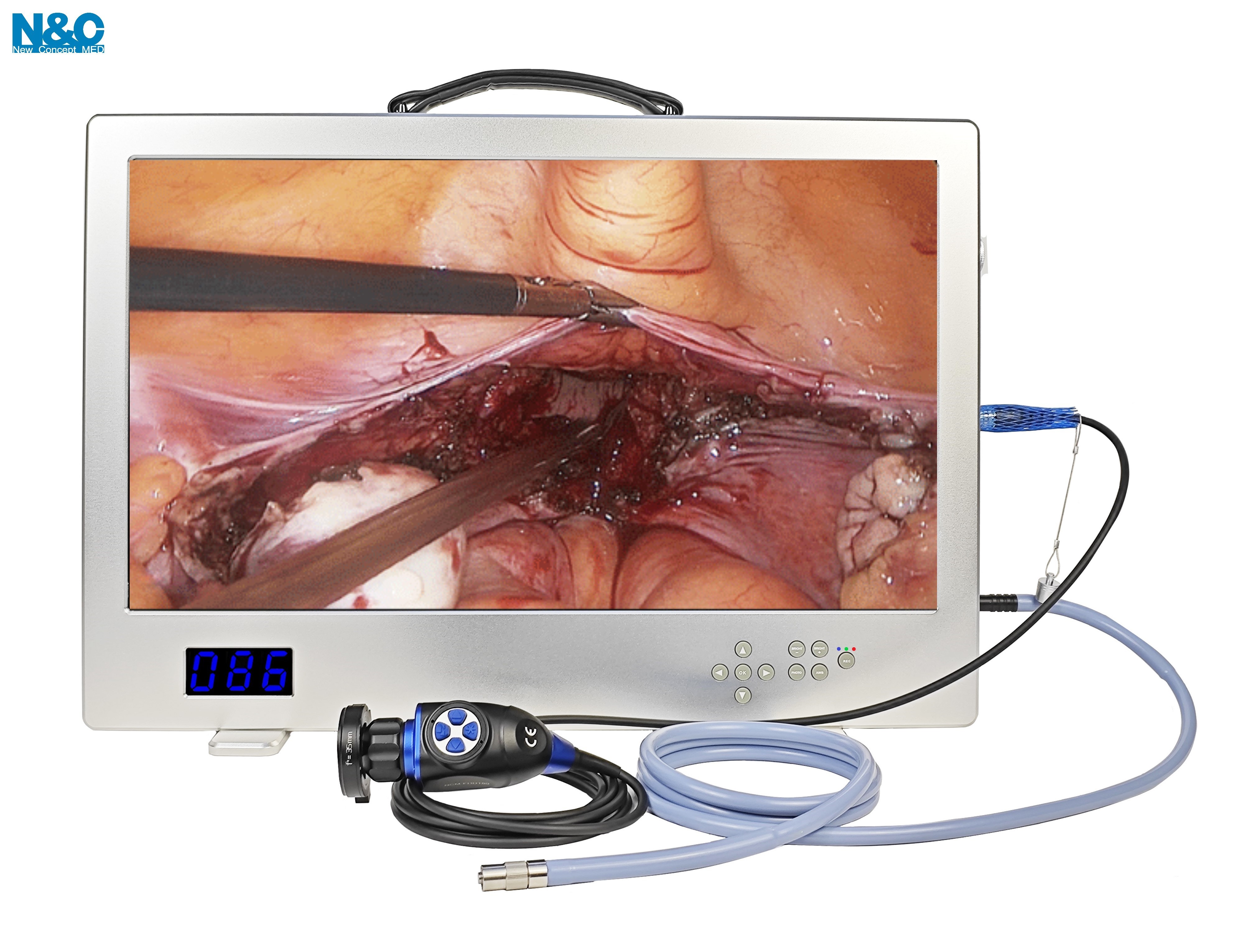 24-Inch Integrated 1080P Endoscope Camera System - All-in-One Endoscopy Camera