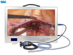 24-Inch Integrated 1080P Endoscope Camera System - All-in-One Endoscopy Camera