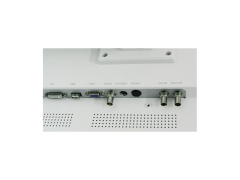 24 inches monitor– All-in-One Endoscopy Camera