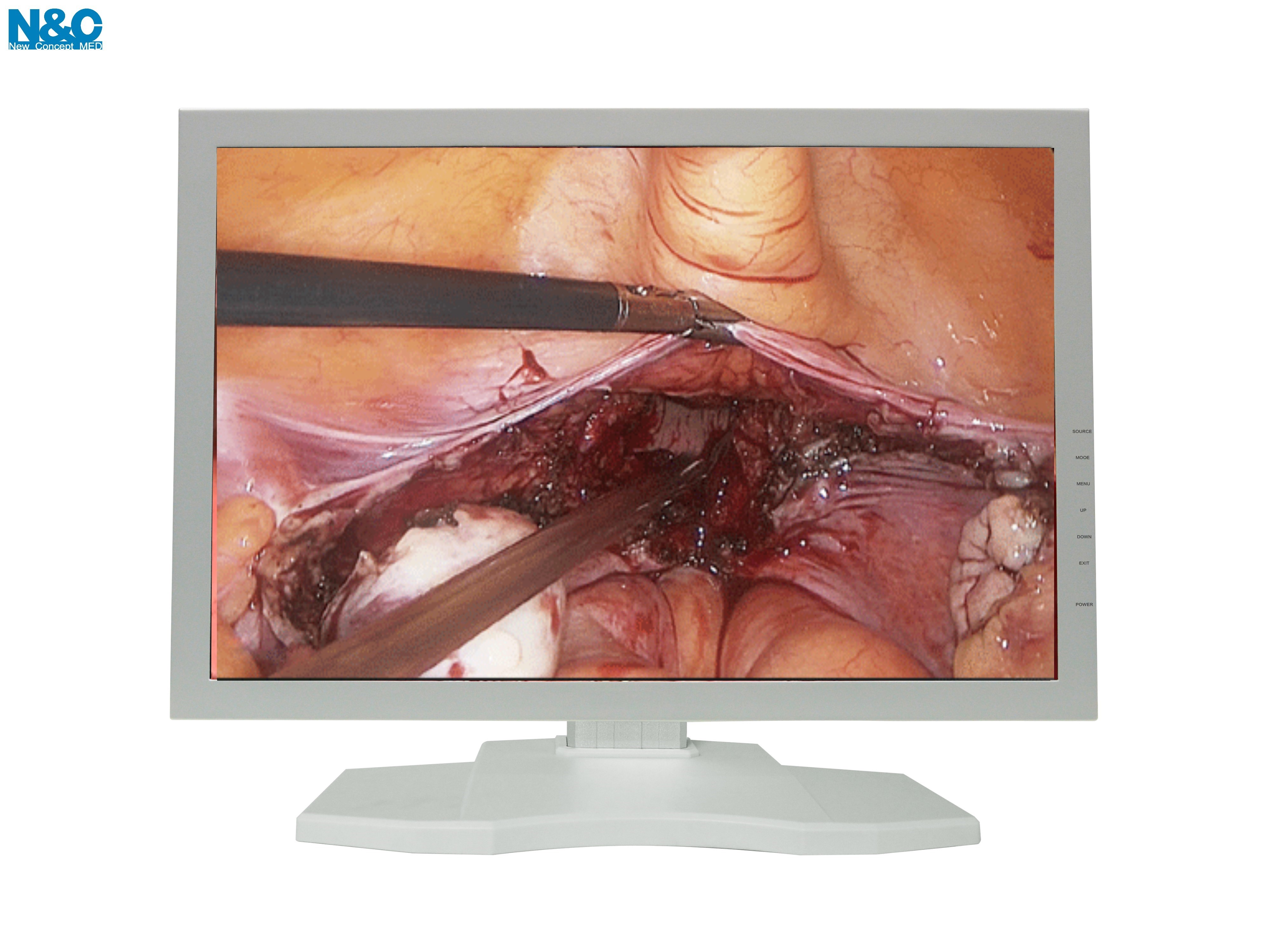 24 inches monitor– All-in-One Endoscopy Camera