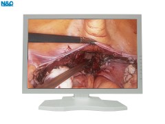 24 inches monitor– All-in-One Endoscopy Camera